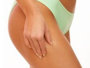 Foto Noticia ¡Stop Celulitis!
